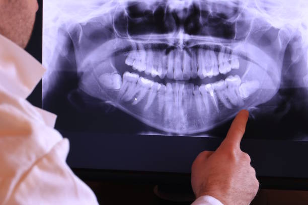 Best Holiday Emergency Dentist in Barview, OR