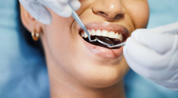 Best Emergency Dental Care for Abscessed Tooth in Barview, OR